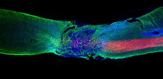 The Journey to Become Limitless